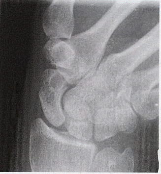 Diagrama Posición 2